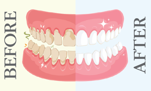 Accidental Discovery that Led To the First Gum Restore Toothpaste
