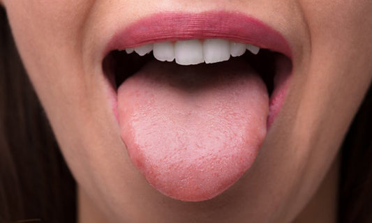 Vaccinated Tongue