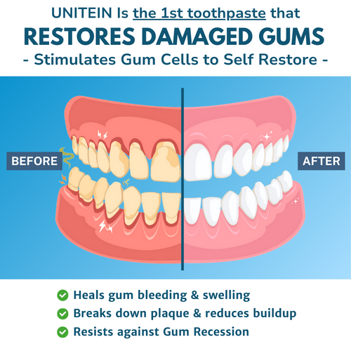 UNITEIN Gum Restore Toothpaste SAMPLE